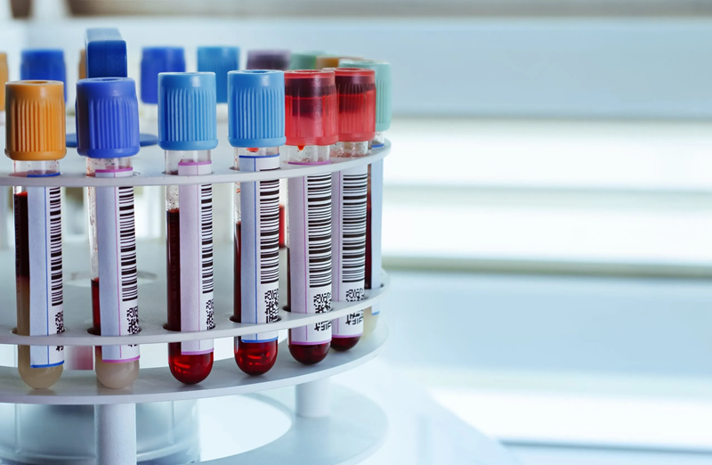 BioiVT-X3-CaseStudy Vials containing chemical samples